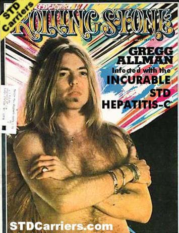 Gregg Allman
